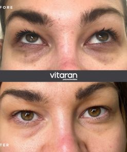 Alternative view of VITARAN I (2 x 1ml)