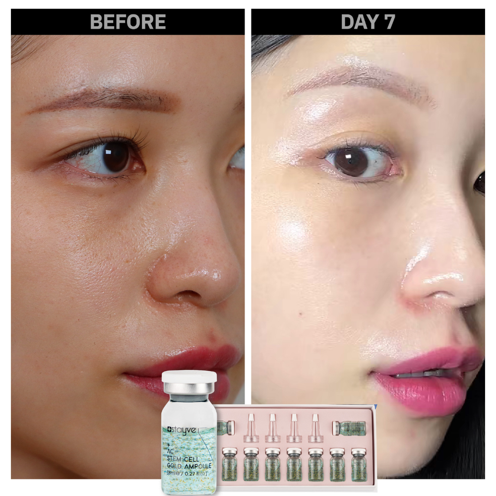 Stayve Booster Starter Kit (Microneedling Ampoule) - Image 8