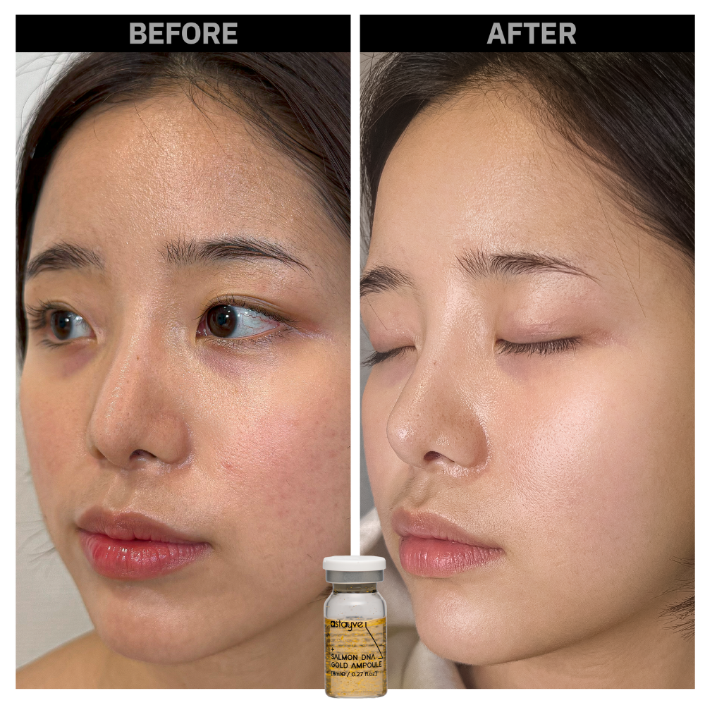 Stayve Booster Starter Kit (Microneedling Ampoule) - Image 5