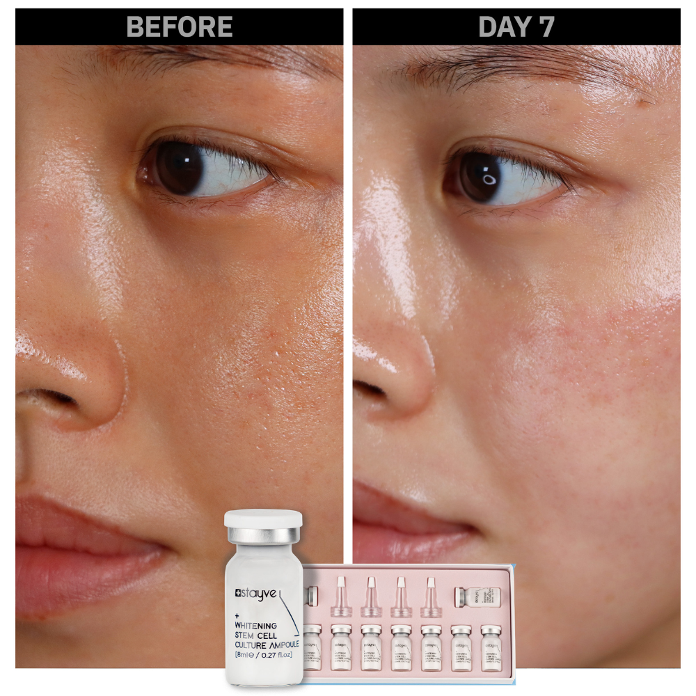 Stayve Booster Starter Kit (Microneedling Ampoule) - Image 12