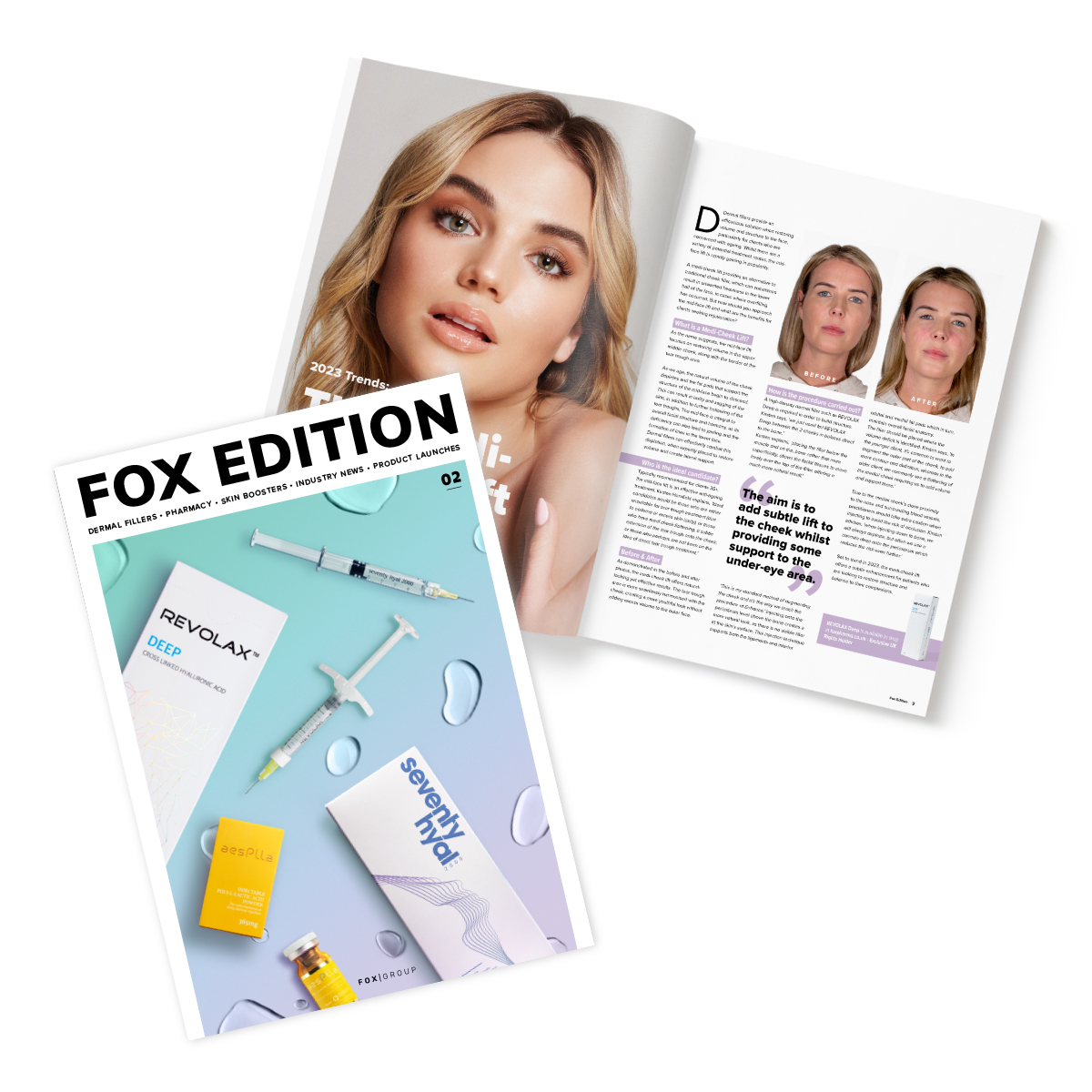 Fox Edition 02